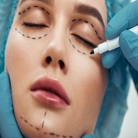 Becoming perfect. Close up photo of young woman with glowing skin in blue medical hat waiting for facial surgery while plastic surgeon in blue gloves drawing dashed line under eyes. Beauty concept. Facelift. Plastic surgery